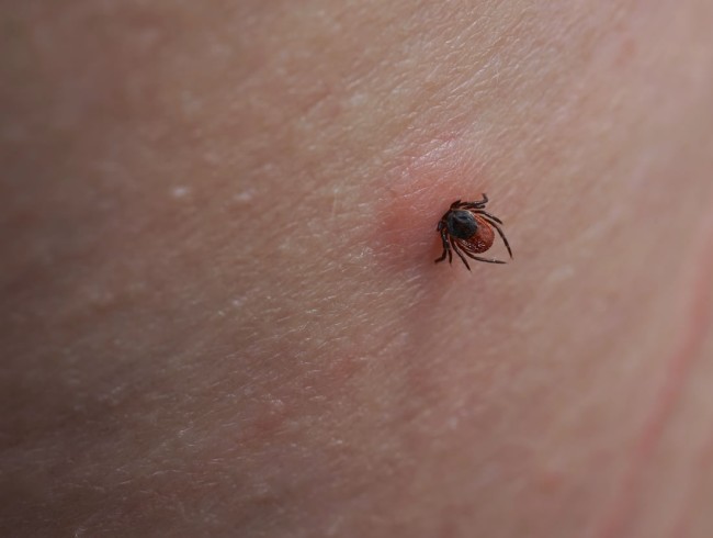 Zeckenbiss © Shutterstock